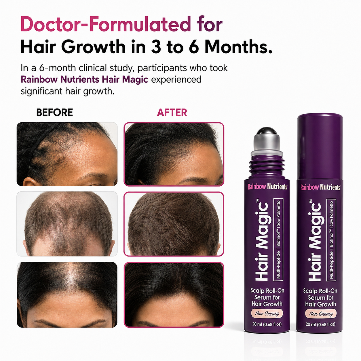 Advanced Hair Growth Serum for Women*